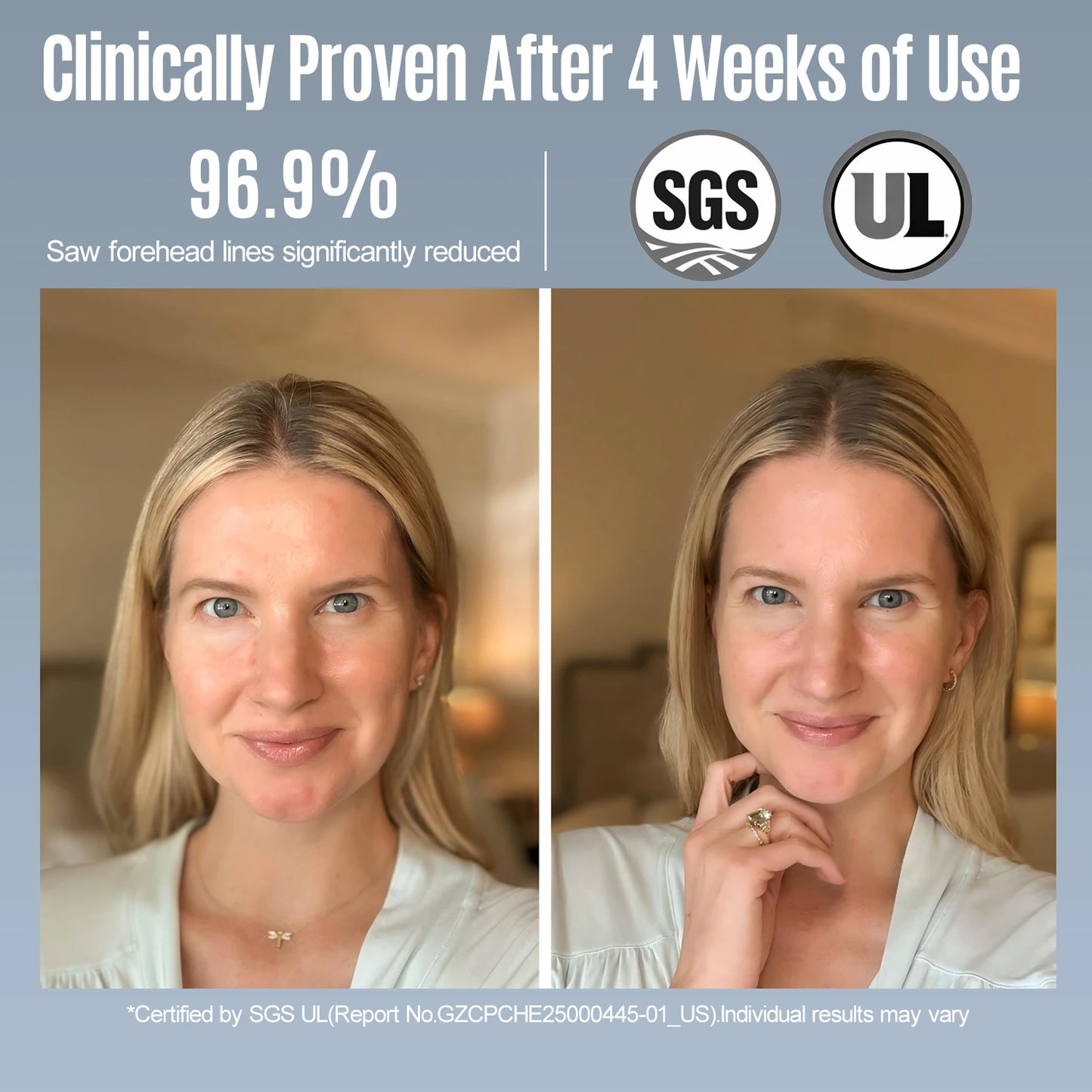 Ibeaucare LUMERA 10 Pro Red Light Face Mask