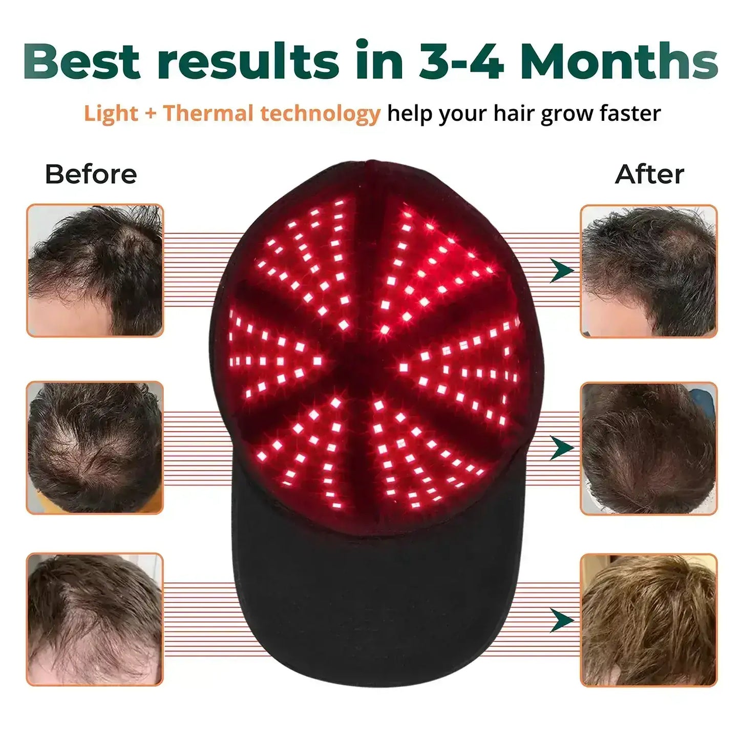 LED Red Light Therapy Cap for Natural Hair Regrowth