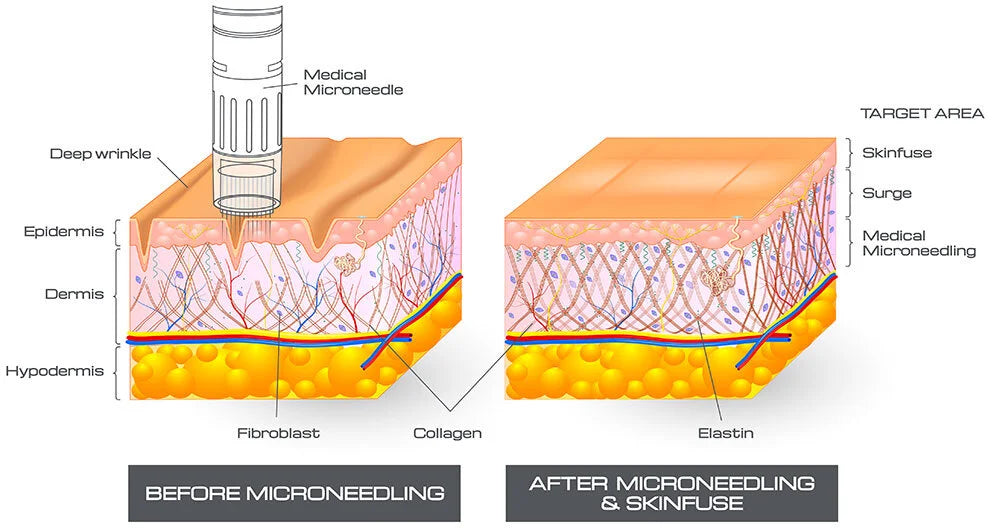 Skin Rejuvenation