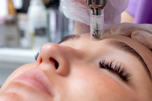 Microneedling Pen for Aging Skin: Boost Collagen, Reduce Wrinkles & Restore Youthful Glow