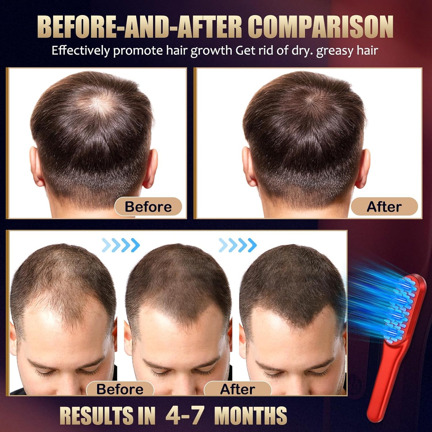 Hair Growth Comb，Red Light Hair Growth Treatment
