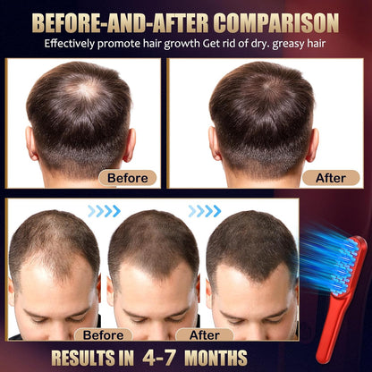 Hair Growth Comb，Red Light Hair Growth Treatment