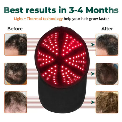 LED Red Light Therapy Cap for Natural Hair Regrowth