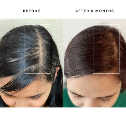 New hair growth!