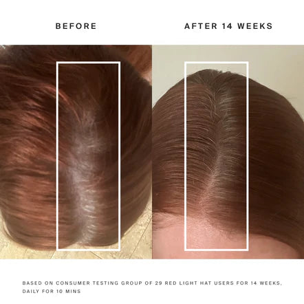5 star rating Worth the cost for better, more luxurious hair
