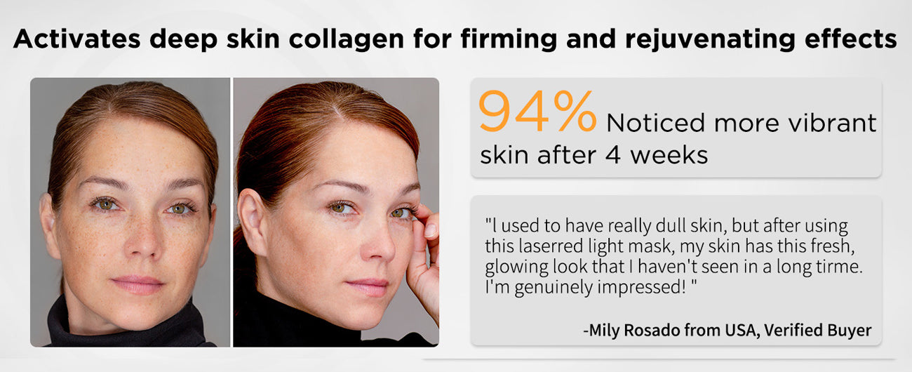 DIMINISHED WRINKLES