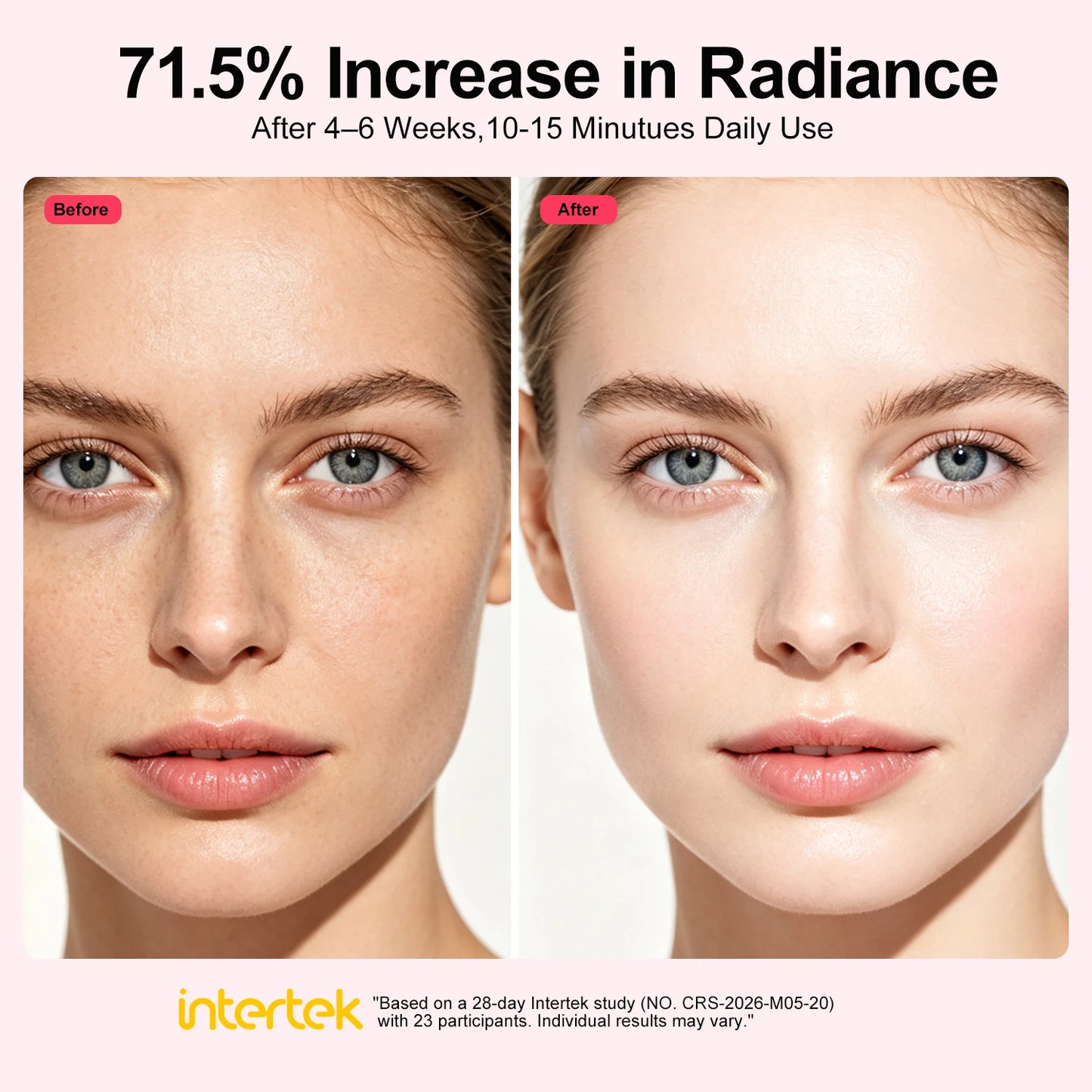 SUNTUE Glow 4D Wireless Red Light Face Mask