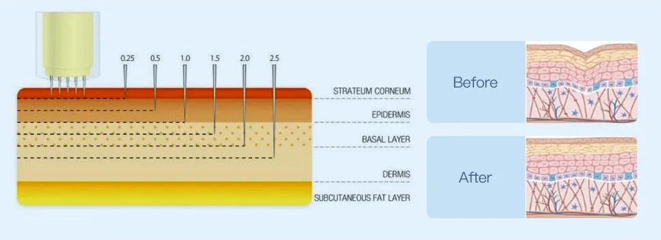 Collagen Stimulation